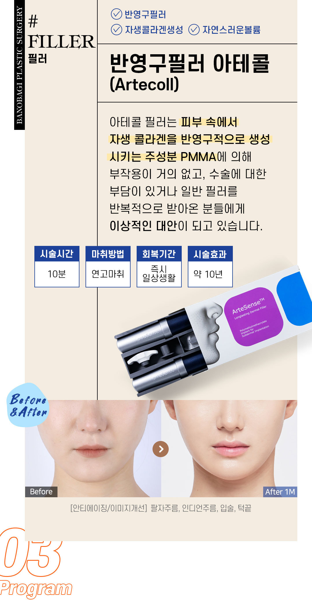 필러