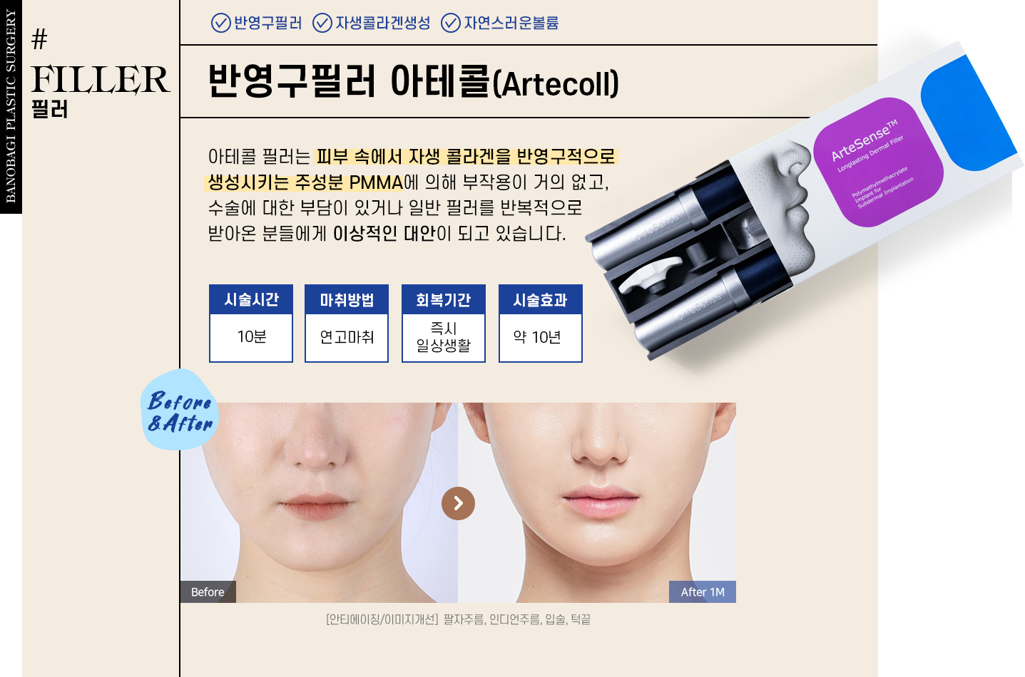 필러