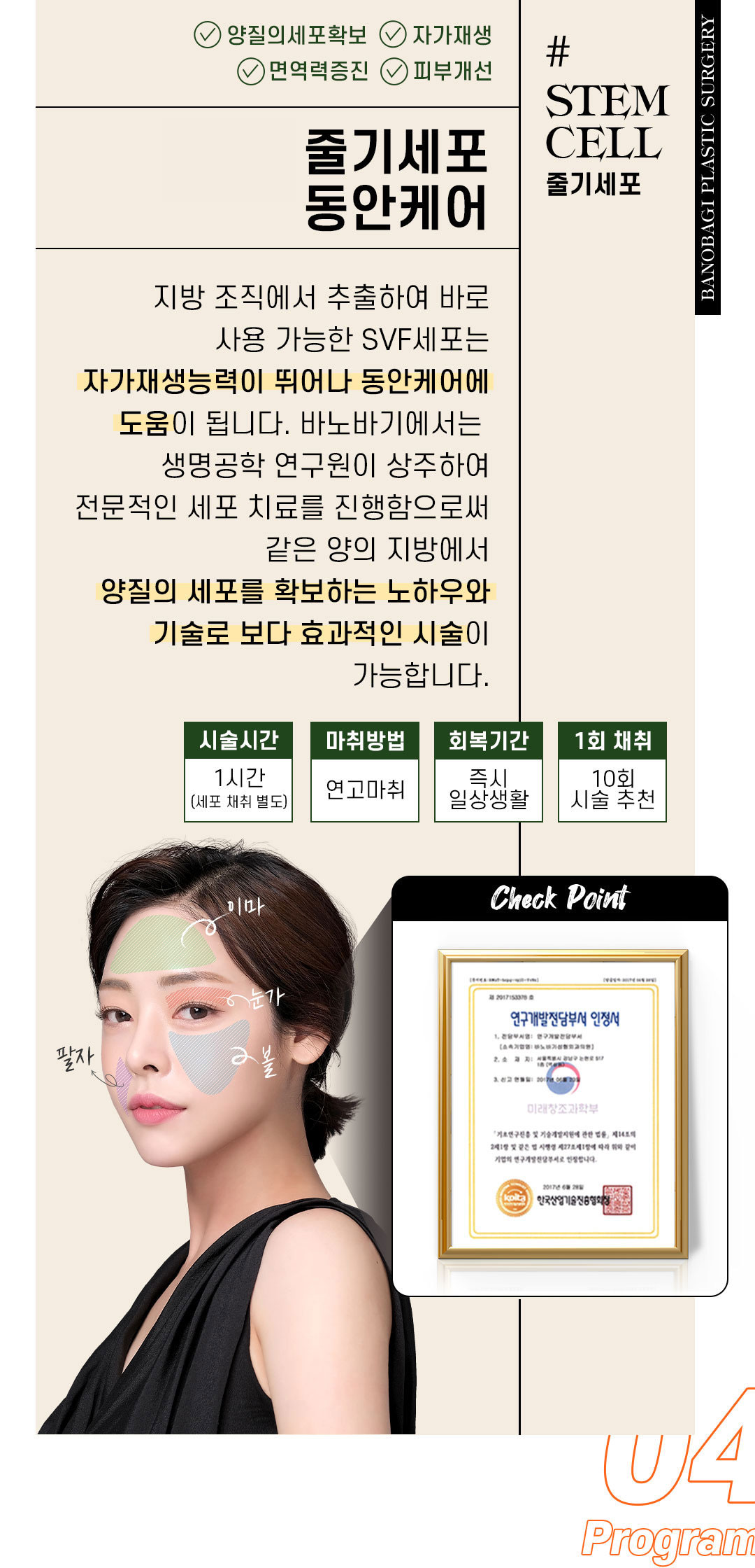 줄기세포