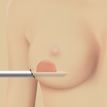 유방이미지