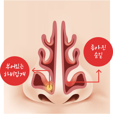 코이미지