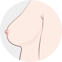 정상
