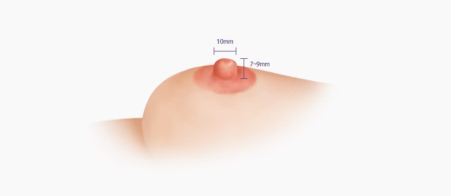 일반적인 유두의 크기:높이 7-9mm, 직경 10mm