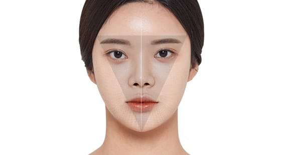 앞턱의 형태를 바로잡아 얼굴의 중심선 정렬