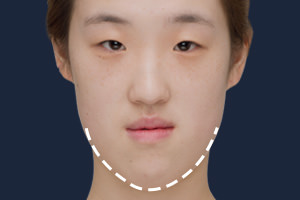 턱이 길고 돌출된 얼굴