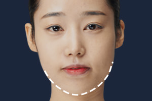 턱이 삐뚤어진 얼굴