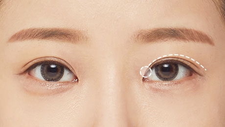 다양하게 구현할 수 있는 쌍꺼풀 라인 - 인-아웃 중간라인