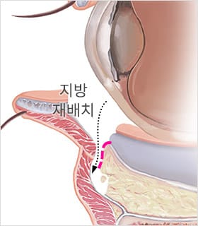 STEP 02 지방재배치
