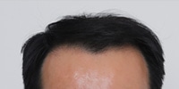 M자형