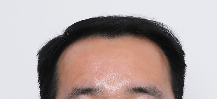 C자형
