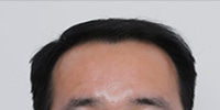 C자형