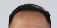 복합형