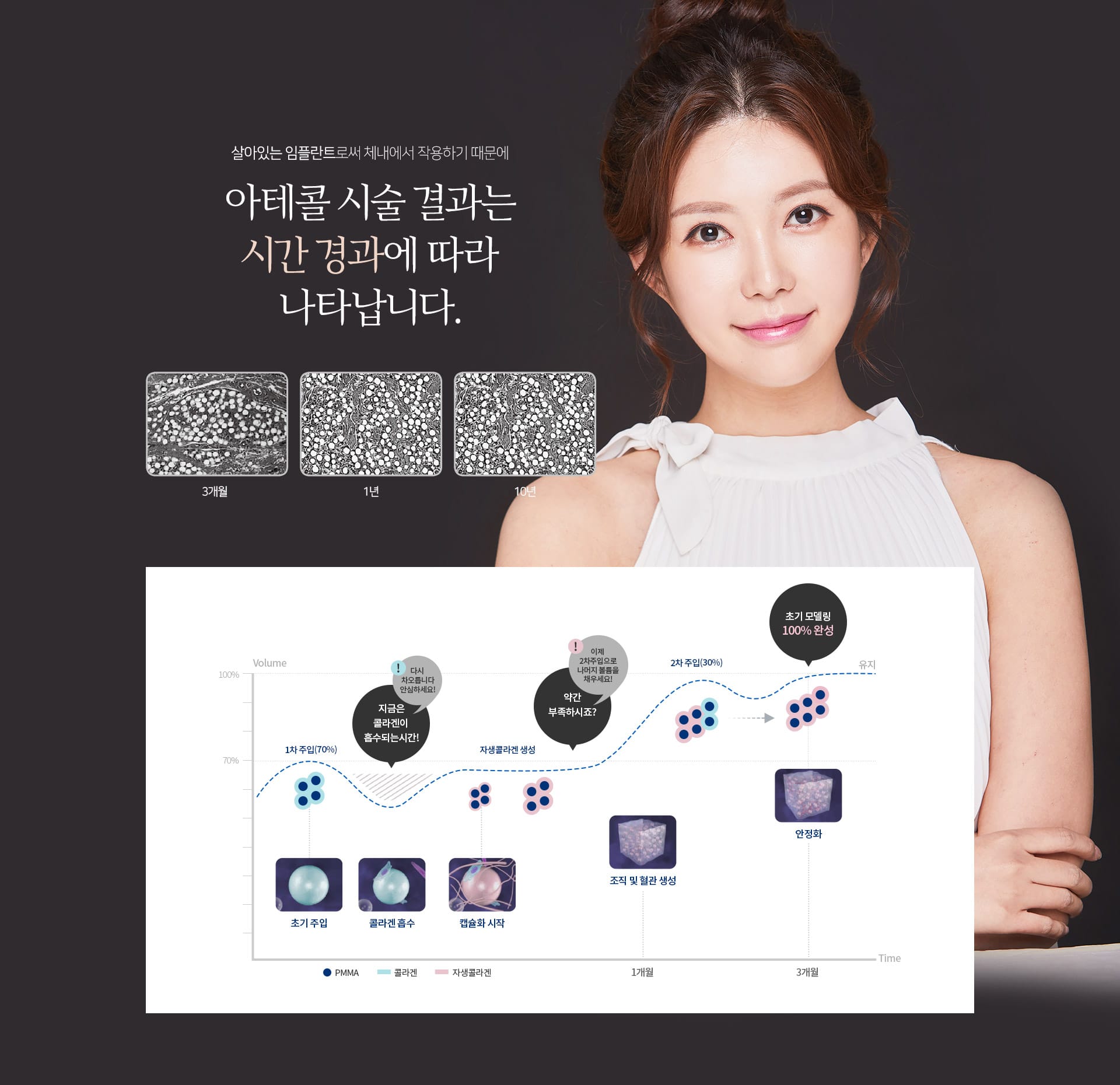 살아있는 임플란트로써 체내에서 작용하기 때문에 아테콜 시술 결과는 시간 경과에 따라 나타납니다.