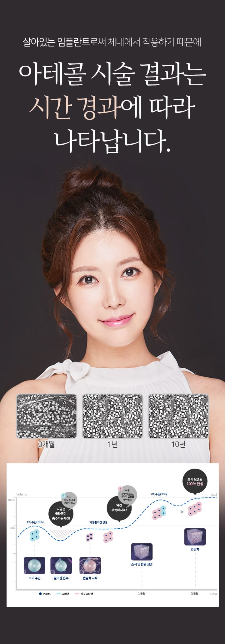 살아있는 임플란트로써 체내에서 작용하기 때문에 아테콜 시술 결과는 시간 경과에 따라 나타납니다.