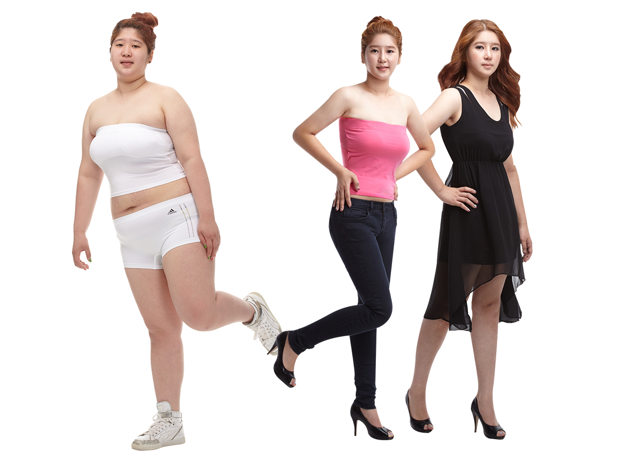 전신지방흡입 모델