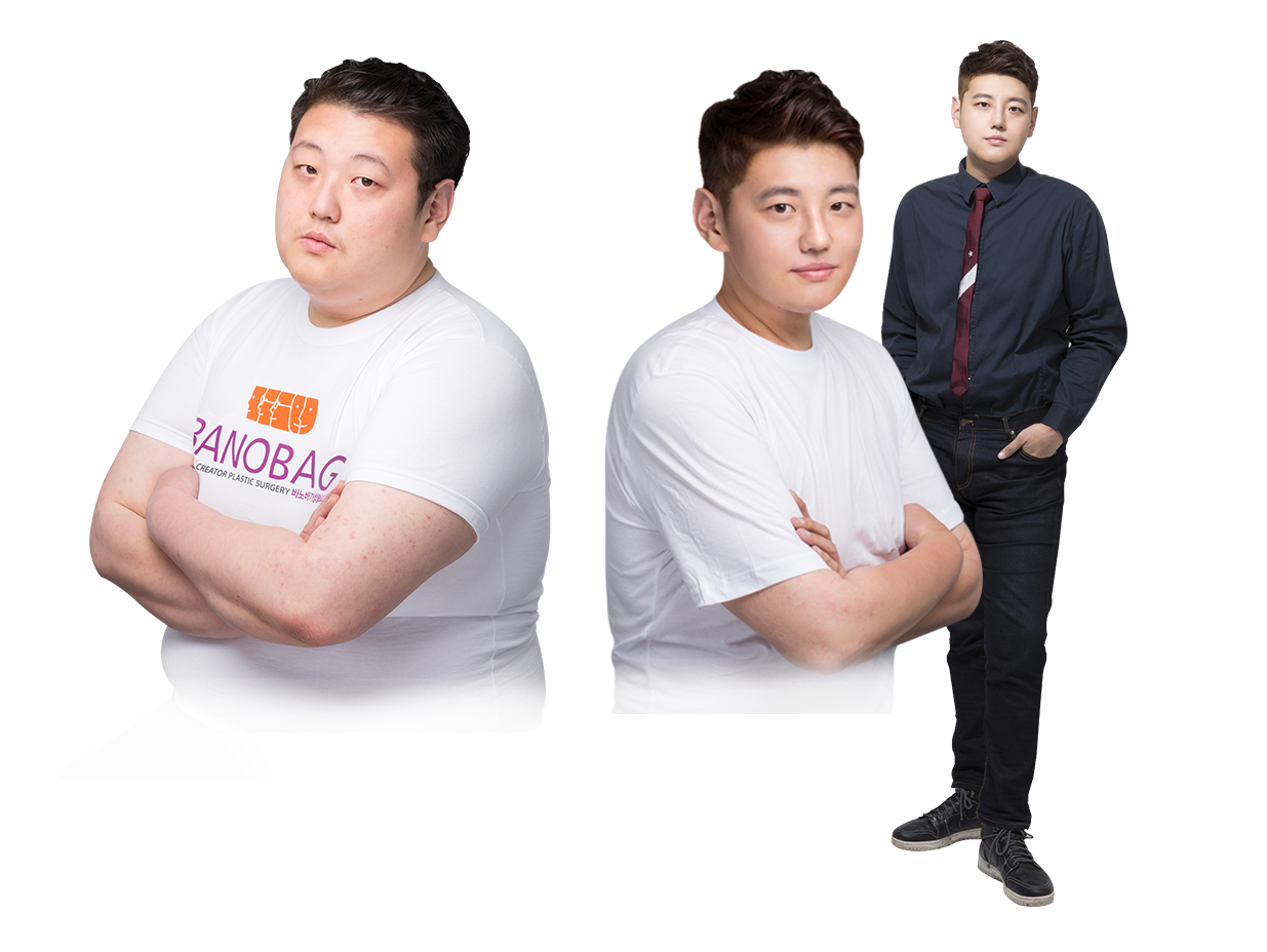 전신지방흡입 모델