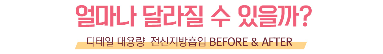 얼마나 달라질 수 있을까? - 디테일 대용량 전신지방흡입 BEFORE & AFTER