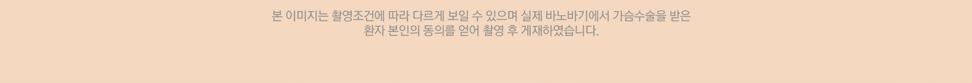본 이미지는 촬영조건에 따라 다르게 보일 수 있으며 실제 바노바기에서 가슴수술을 받은 환자 본인의 동의를 얻어 촬영 후 게재하였습니다.