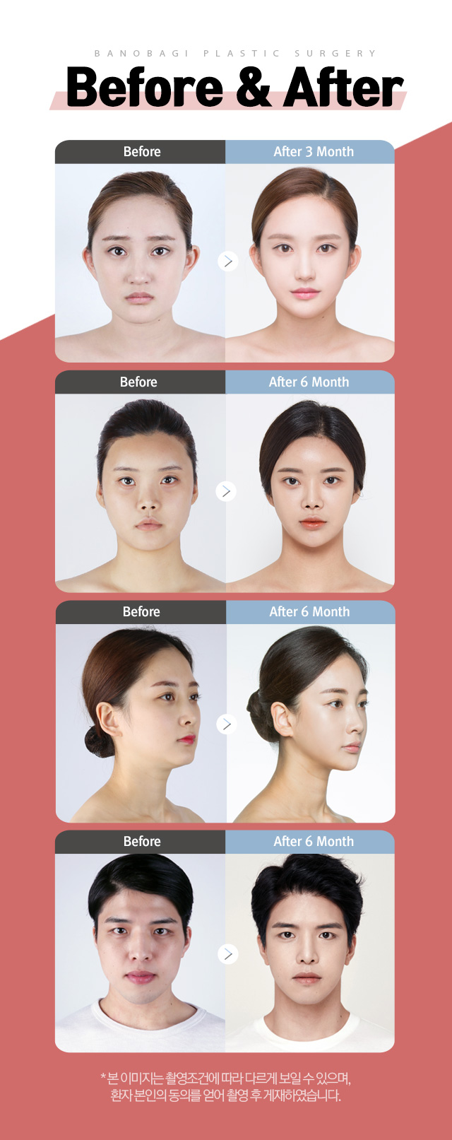 Before & After