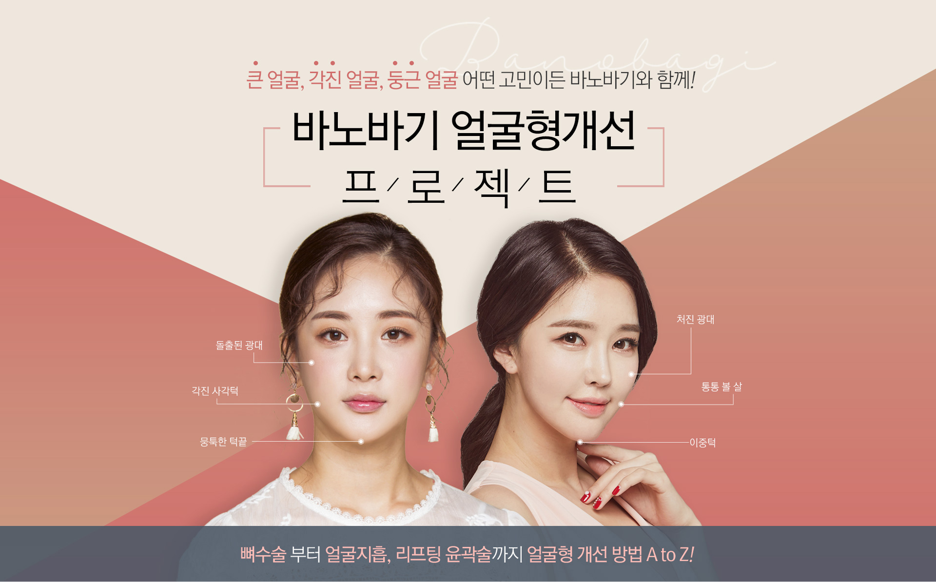 바노바기 얼굴형개선 프로젝트