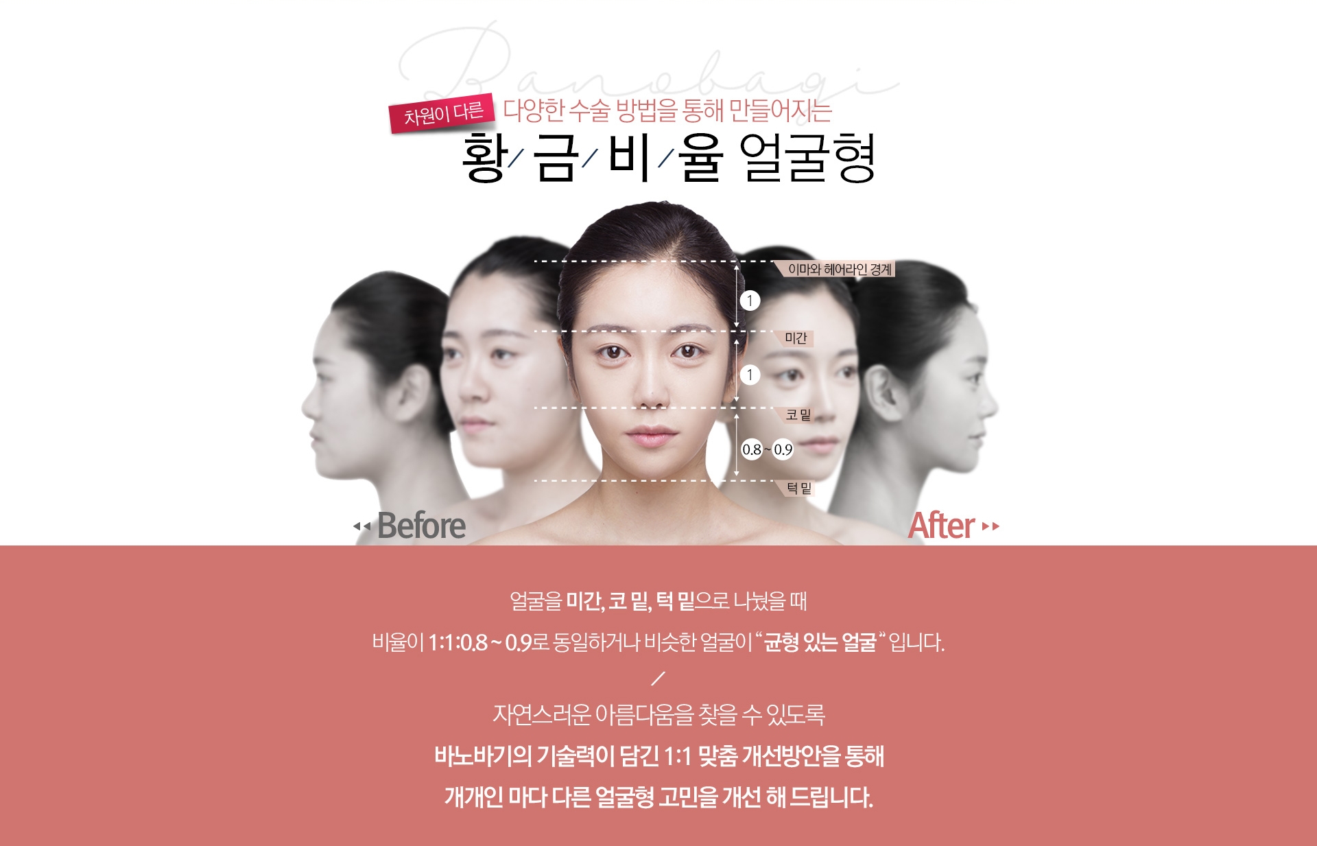 차원이 다른 다양한 수술 방법을 통해 만들어지는 황금비율 얼굴형