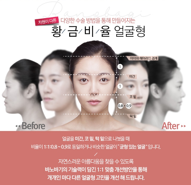 차원이 다른 다양한 수술 방법을 통해 만들어지는 황금비율 얼굴형