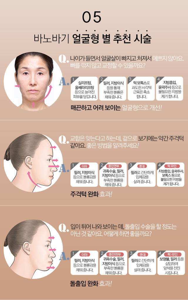 05 - 바노바기 얼굴형 별 추천 시술