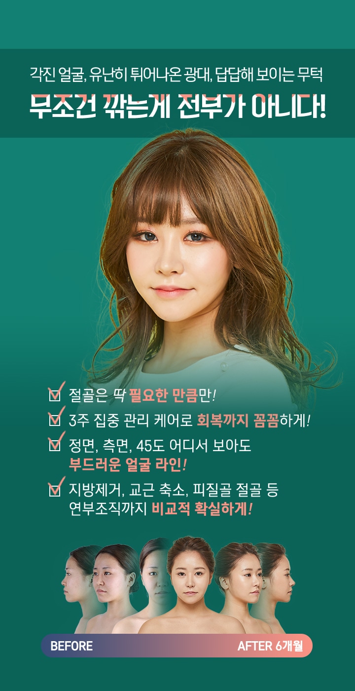 각진 얼굴, 유난히 튀어나온 광대, 답답해 보이는 무턱 - 무조건 깎는게 전부가 아니다!
