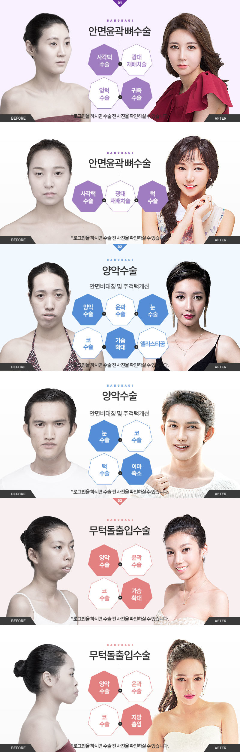 before,after
