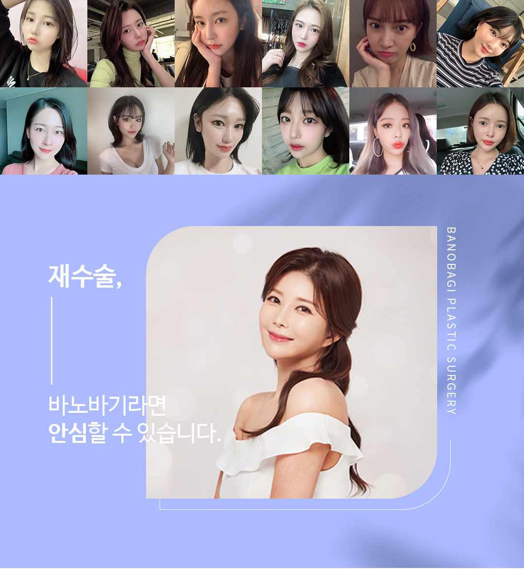 재수술, 바노바기라면 안심할 수 있습니다.