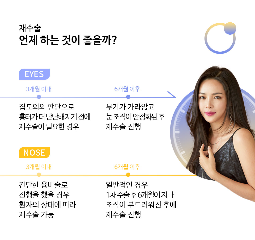재수술 언제 하는 것이 좋을까?