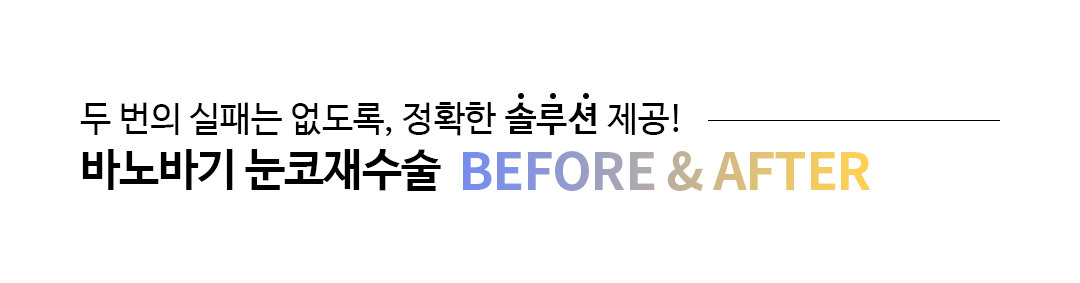 두 번의 실패는 없도록, 정확한 솔루션 제공! 바노바기 눈코재수술 BEFORE & AFTER