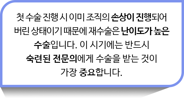 첫 수술 진행 시 이미 조직의 손상이 진행되어 버린 상태이기 때문에 재수술은 난이도가 높은 수술입니다. 이 시기에는 반드시 숙련된 전문의에게 수술을 받는 것이 가장 중요합니다.