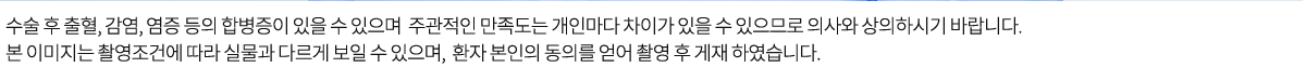 수술 후 출혈, 감염, 염증 등의 합병증이 있을 수 있으며 주관적인 만족도는 개인마다 차이가 있을 수 있으므로 의사와 상의하시기 바랍니다.