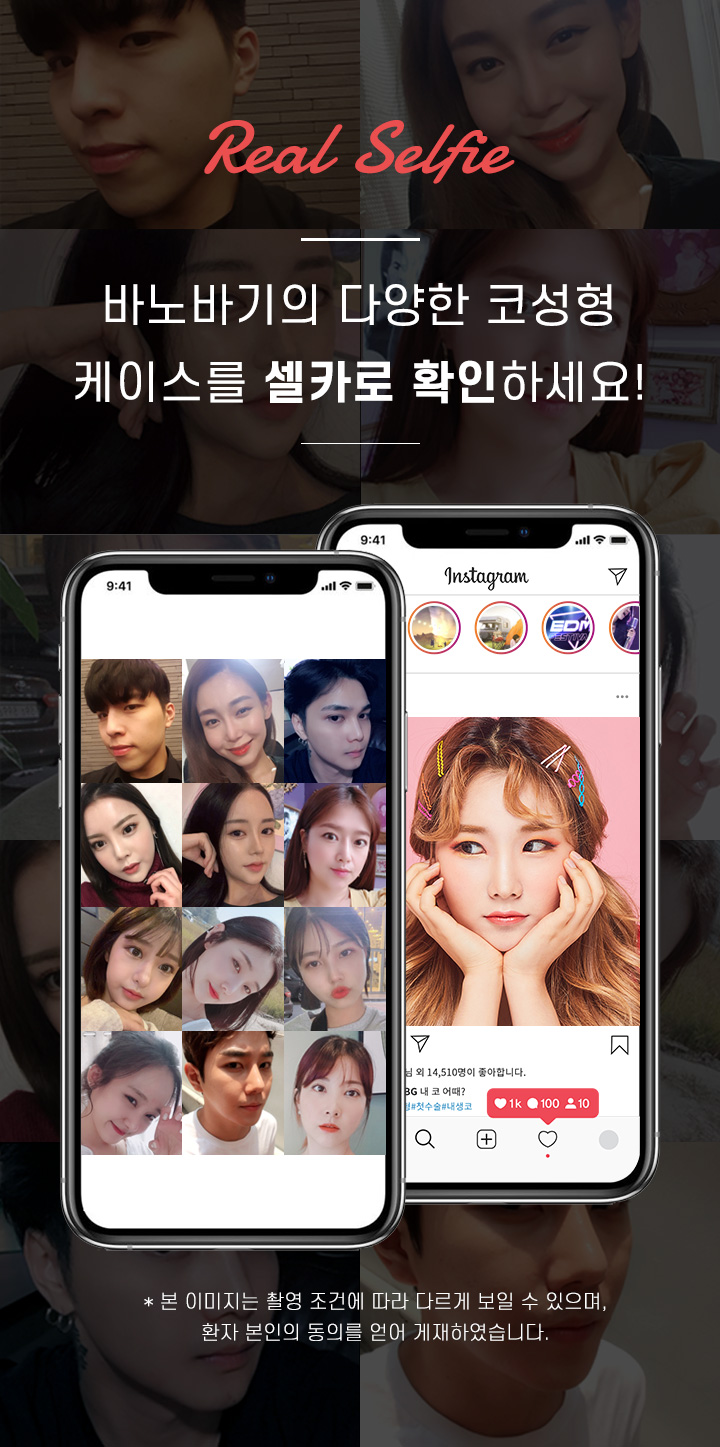 바노바기의 다양한 코성형 케이스를 셀카로 확인하세요!