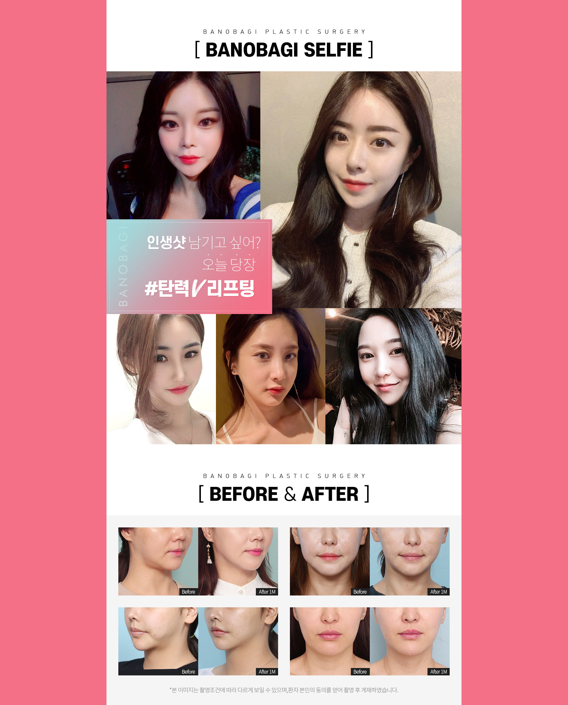 BEFORE & AFTER