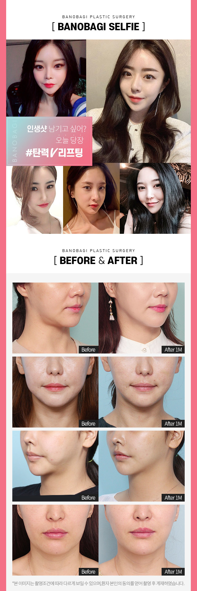 BEFORE & AFTER