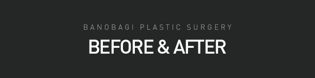 BEFORE & AFTER